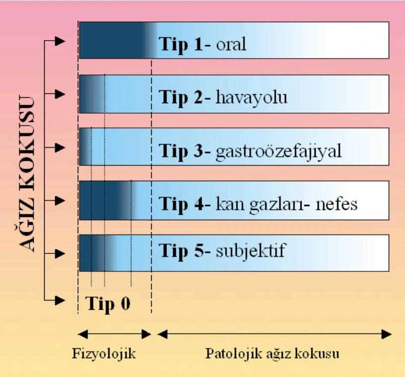 Ağız kokusu sınıflaması (aydın M, 2014)